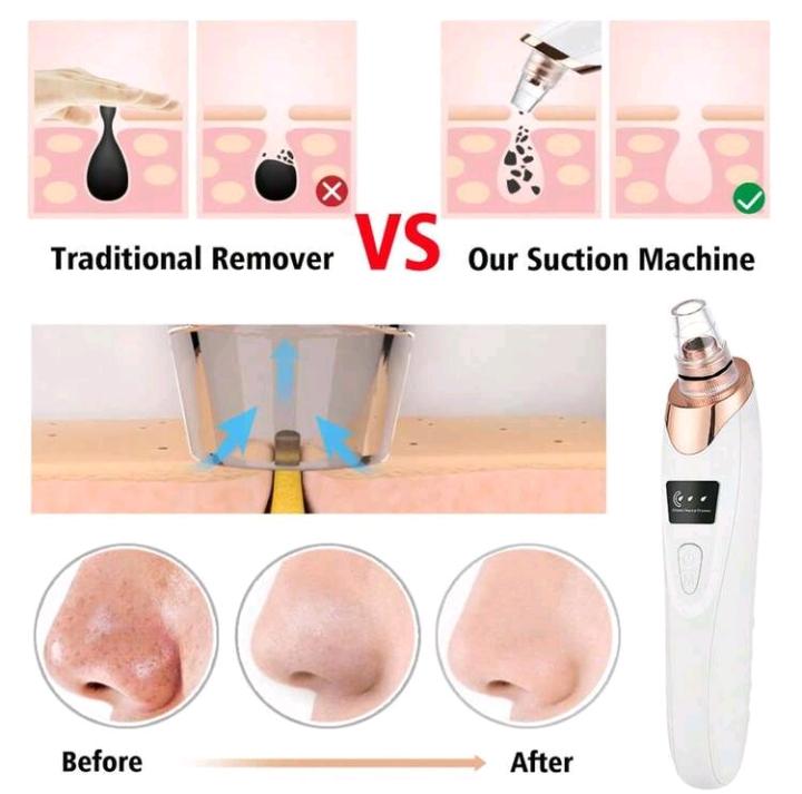 Electric Blackhead Vacuum Remover Kit