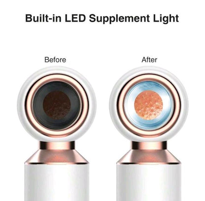 Electric Blackhead Remover